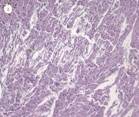 心脏染色,心脏染色揭示生命之泵的奥秘与美丽