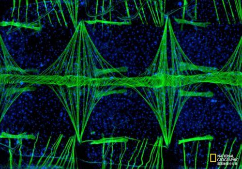 心脏染色,心脏染色揭示生命之泵的奥秘与美丽  第2张
