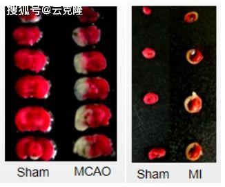 心脏染色,心脏染色揭示生命之泵的奥秘与美丽  第3张